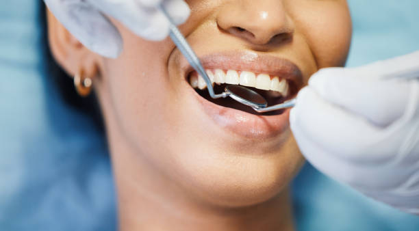 Best Broken or Cracked Tooth Emergency Dentist in Oakland City, IN